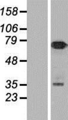 Western Blot: Numb Overexpression Lysate [NBP2-08848]