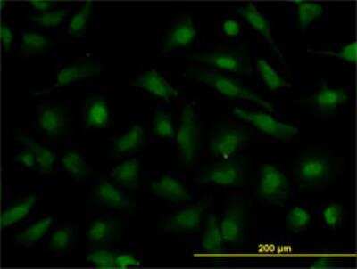 Immunocytochemistry/ Immunofluorescence: NUP133 Antibody (3E8) [H00055746-M01]