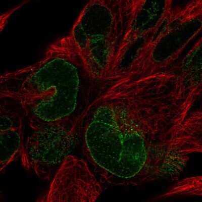 Immunocytochemistry/ Immunofluorescence: NUP133 Antibody [NBP2-31795]