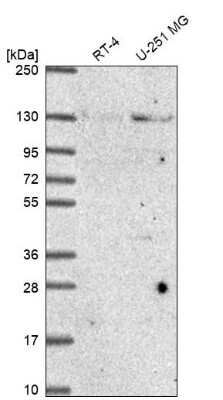 Western Blot: NUP133 Antibody [NBP2-31795]