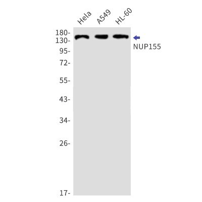 Western Blot: NUP155 Antibody (S03-6F7) [NBP3-19898]
