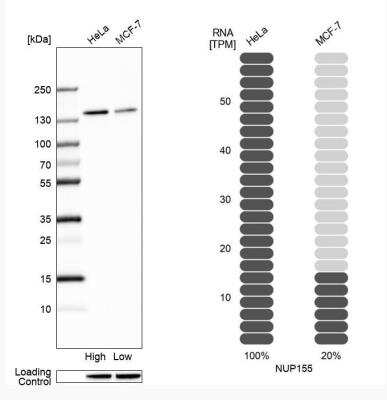 Western Blot: NUP155 Antibody [NBP1-82960]