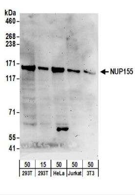 Western Blot: NUP155 Antibody [NBP2-22286]
