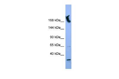 Western Blot: NUP155 Antibody [NBP2-87968]