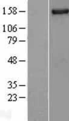 Western Blot: NUP155 Overexpression Lysate [NBL1-13872]