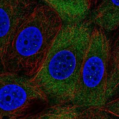 Immunocytochemistry/ Immunofluorescence: NUP210L Antibody [NBP2-55600]