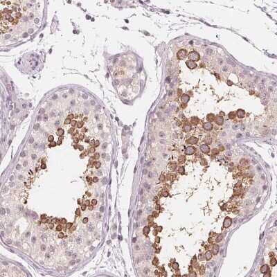 Immunohistochemistry: NUP210L Antibody [NBP2-49414]