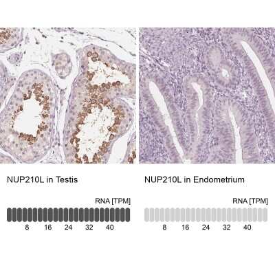 Immunohistochemistry-Paraffin: NUP210L Antibody [NBP2-49414]