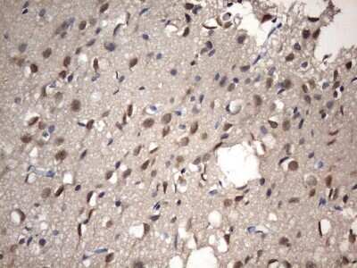 Immunohistochemistry: NUP43 Antibody (OTI6F8) [NBP2-46285]