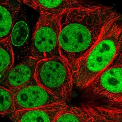 Immunocytochemistry/ Immunofluorescence: NUP50 Antibody [NBP2-13683]
