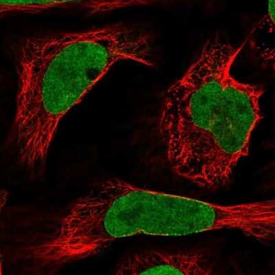 Immunocytochemistry/ Immunofluorescence: NUP50 Antibody [NBP2-57627]