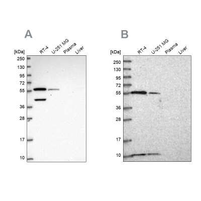 Western Blot: NUP50 Antibody [NBP2-57627]