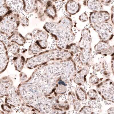 Immunohistochemistry-Paraffin: NUP54 Antibody [NBP1-85899]