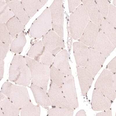 Immunohistochemistry-Paraffin: NUP54 Antibody [NBP1-85899]