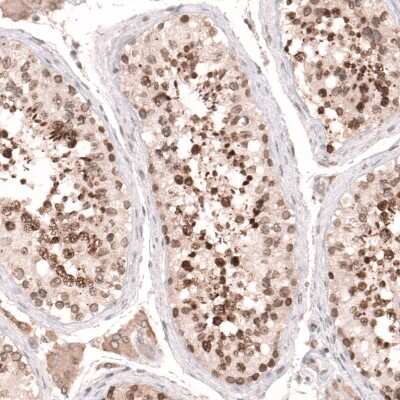 Immunohistochemistry-Paraffin: NUP54 Antibody [NBP1-85899]