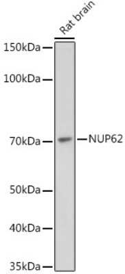 Western Blot: NUP62 Antibody (4V10S5) [NBP3-15729]