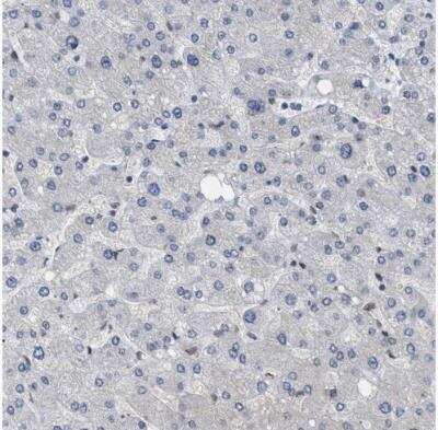 Immunohistochemistry-Paraffin: NUP93 Antibody [NBP1-81546]