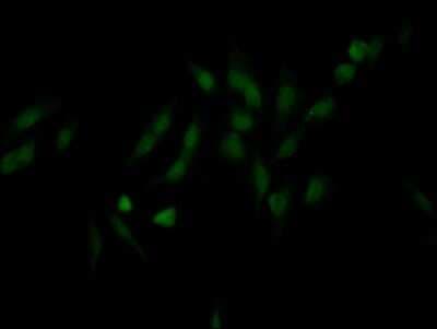 Immunocytochemistry/ Immunofluorescence: NUP98 Antibody (2H4) [NBP3-15200]