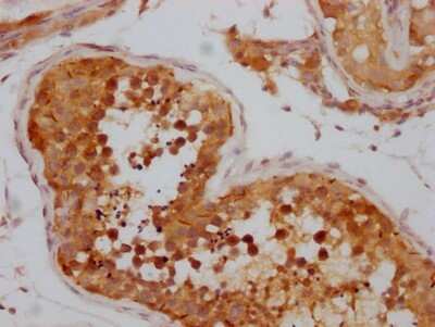 Immunohistochemistry: NUP98 Antibody (2H4) [NBP3-15200]