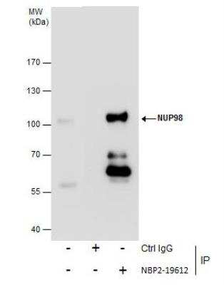 Immunoprecipitation: NUP98 Antibody [NBP2-19612]