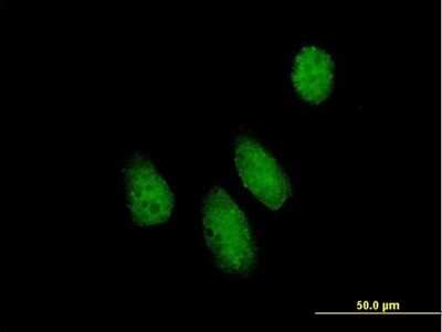 Immunocytochemistry/ Immunofluorescence: NUPL1 Antibody [H00009818-B01P]