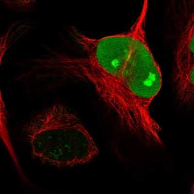 Immunocytochemistry/ Immunofluorescence: NUSAP1 Antibody [NBP2-13685]