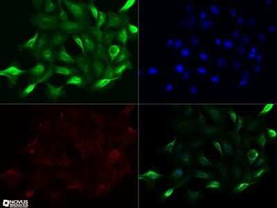 Immunocytochemistry/ Immunofluorescence: NUT Antibody (1G6) - Azide and BSA Free [NBP2-80886]