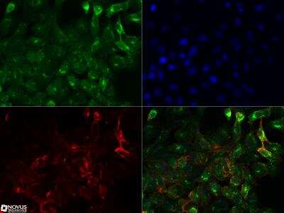 Immunocytochemistry/ Immunofluorescence: NUT Antibody (2B6) - BSA Free [NBP2-31147]