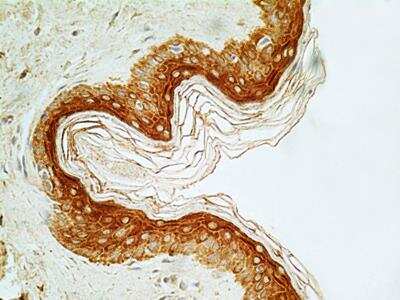 Immunohistochemistry-Paraffin: NUT Antibody (2B6) - BSA Free [NBP2-31147]