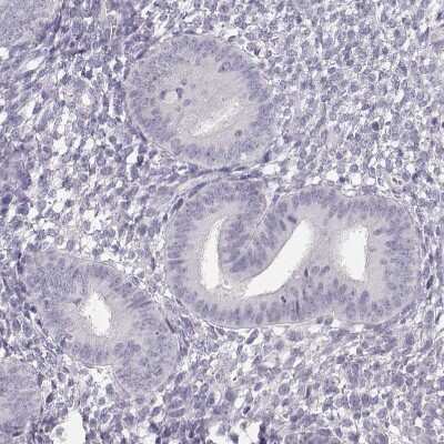 Immunohistochemistry-Paraffin: NUT Antibody [NBP1-84176]