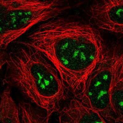 Immunocytochemistry/ Immunofluorescence: NVL Antibody [NBP2-37861]