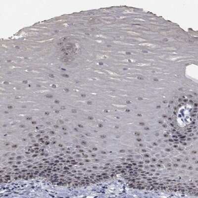 Immunohistochemistry-Paraffin: NVL Antibody [NBP2-37862]