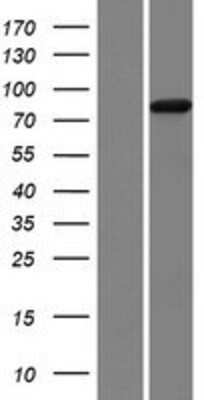 Western Blot: NVL Overexpression Lysate [NBP2-04542]