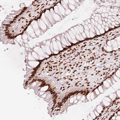 Immunohistochemistry-Paraffin: NXF1 Antibody [NBP2-49341]