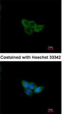 Immunocytochemistry/ Immunofluorescence: NXF2 Antibody [NBP2-15049]