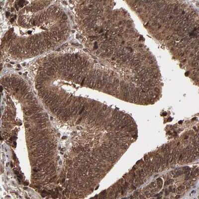 Immunohistochemistry-Paraffin: NXF2 Antibody [NBP1-85809]