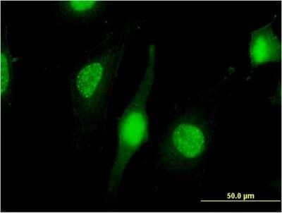 Immunocytochemistry/ Immunofluorescence: NXF3 Antibody (3A9) [H00056000-M06]