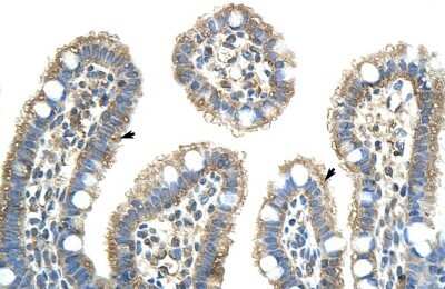 Immunohistochemistry-Paraffin: NXF5 Antibody [NBP1-57260]