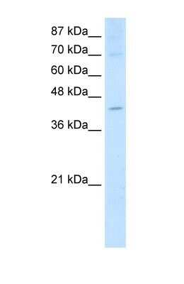 Western Blot: NXF5 Antibody [NBP1-57260]
