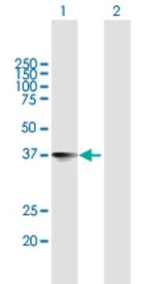 Western Blot: NXPH4 Antibody [H00011247-B01P]