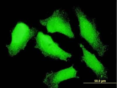 Immunocytochemistry/ Immunofluorescence: NXT1 Antibody (4F11) [H00029107-M08]