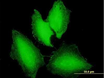 Immunocytochemistry/ Immunofluorescence: NXT1 Antibody [H00029107-B01P]
