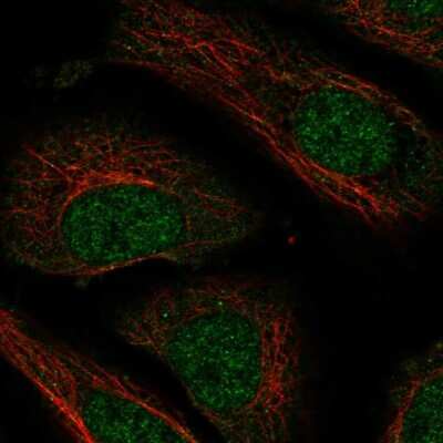 Immunocytochemistry/ Immunofluorescence: NXT2 Antibody [NBP2-58002]