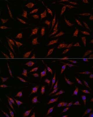 Immunocytochemistry/ Immunofluorescence: NXT2 Antibody - Azide and BSA Free [NBP2-93010]