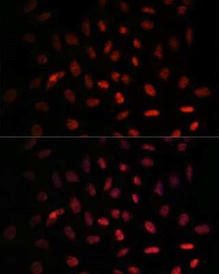 Immunocytochemistry/ Immunofluorescence: NXT2 Antibody - Azide and BSA Free [NBP2-93010]