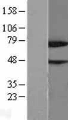 Western Blot: NUB1/NYREN18 Overexpression Lysate [NBL1-13845]