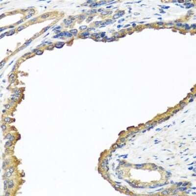 Immunohistochemistry-Paraffin: NYX Antibody - BSA Free [NBP2-94226]