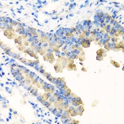 Immunohistochemistry-Paraffin: NYX Antibody - BSA Free [NBP2-94226]