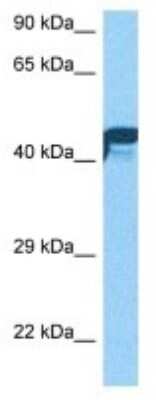Western Blot: NYX Antibody [NBP3-10026]