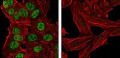 Immunocytochemistry/ Immunofluorescence: Nanog Antibody (1E6C4) - Azide and BSA Free [NBP2-80865]